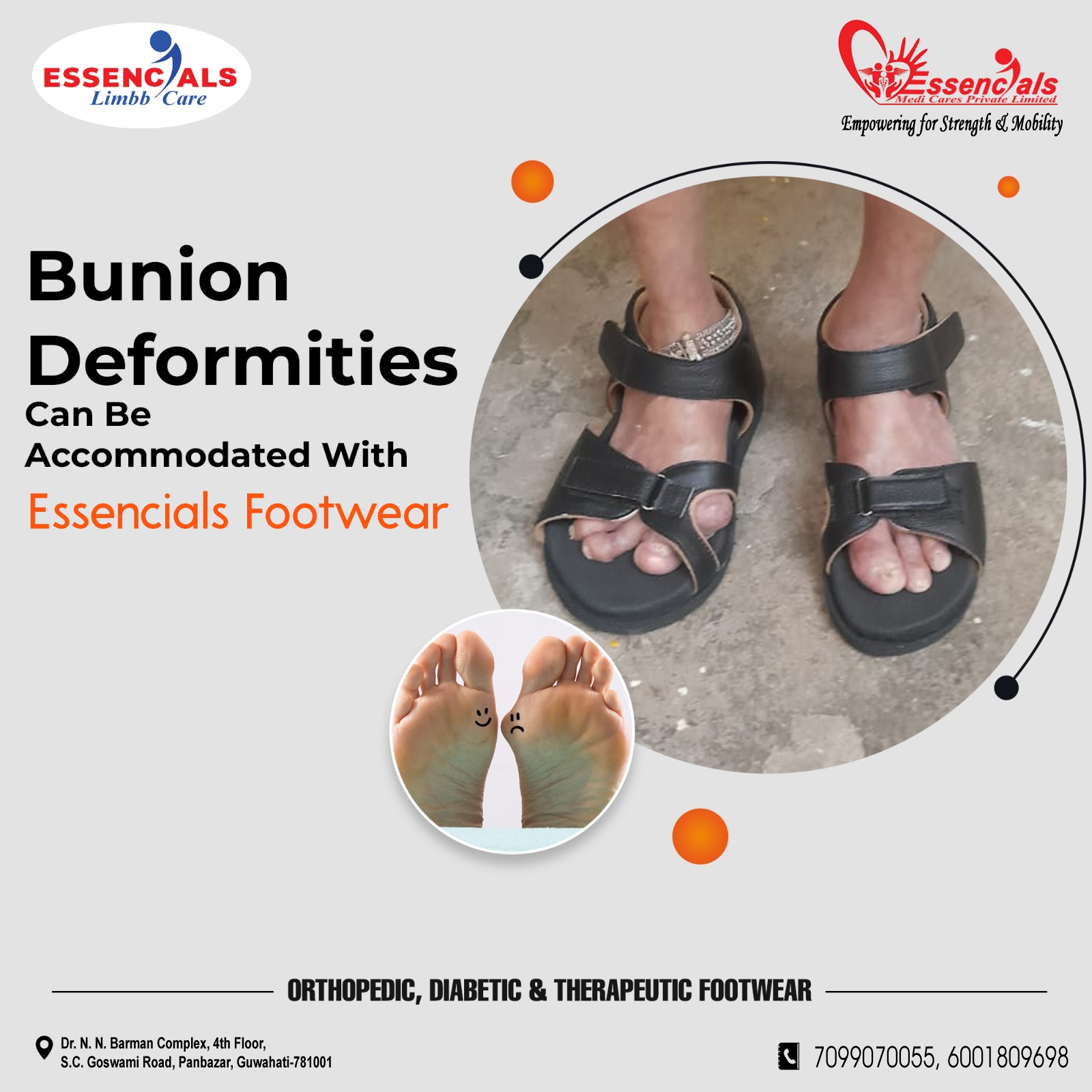 Bunion Deformities footwear